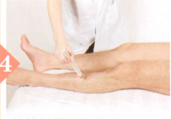 痛风艾灸