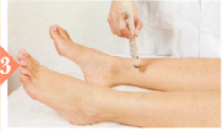 产后尿潴留艾灸