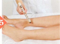 更年期综合征艾灸