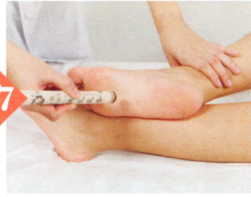 更年期综合征艾灸