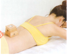 血栓闭塞性脉管炎艾灸