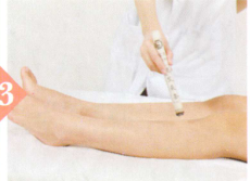 血栓闭塞性脉管炎艾灸