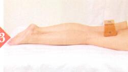 坐骨神经痛艾灸