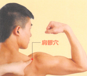 肩周炎艾灸