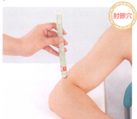 肘关节痛艾灸