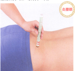 腰间盘突出症艾灸