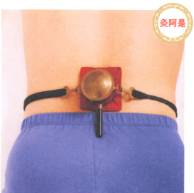 坐骨神经痛艾灸