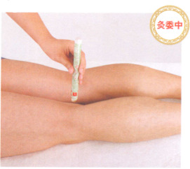 坐骨神经痛艾灸