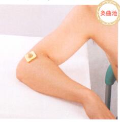 风湿性关节炎艾灸