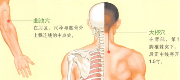 类风湿性关节炎艾灸