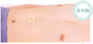 延年益寿艾灸调理方艾灸