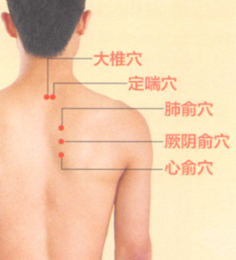 慢性支气管炎艾灸