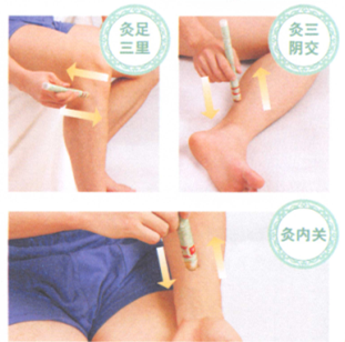 动脉粥样硬化艾灸