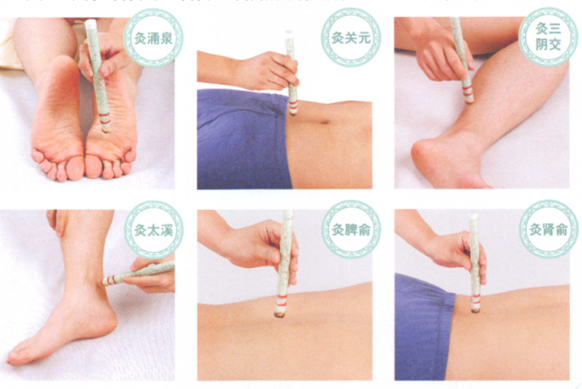 老年痴呆症艾灸