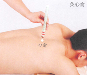 心悸艾灸