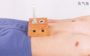 消化性溃疡艾灸