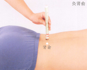 慢性腰肌劳损艾灸