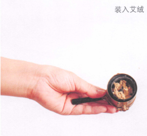 慢性腰肌劳损艾灸