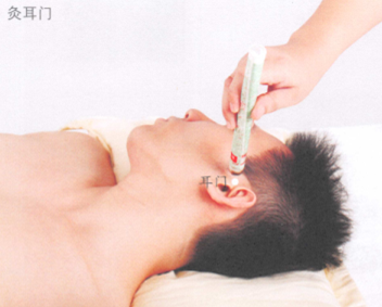 耳鸣艾灸