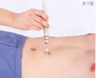 细菌性痢疾艾灸