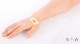 过敏性鼻炎艾灸