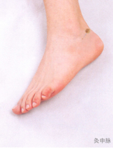 踝关节扭伤艾灸