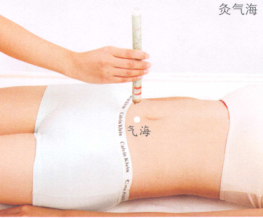 习惯性流产艾灸