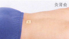 遗精艾灸