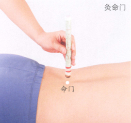 男性不育症艾灸