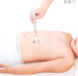 小儿厌食艾灸