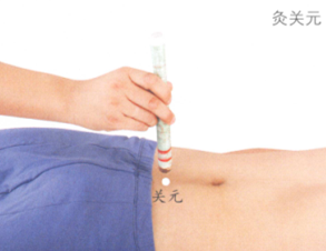 青壮年保健艾灸