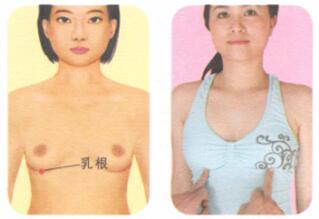 乳腺增生按摩