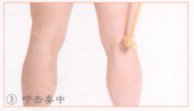 坐骨神经痛按摩