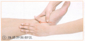 踝关节扭伤按摩