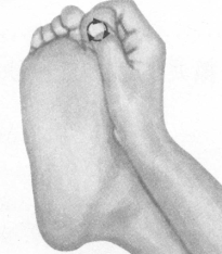 腰椎间盘突出症按摩