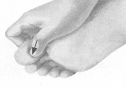 更年期综合征按摩