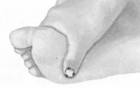 更年期综合征按摩