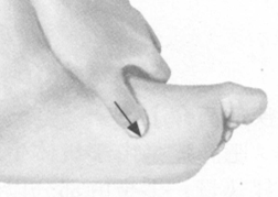 更年期综合征按摩