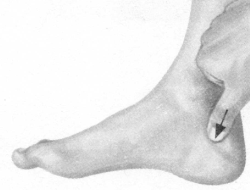 前列腺疾病按摩