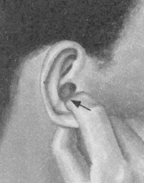 腰椎间盘突出症按摩