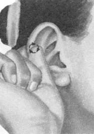 腰椎间盘突出症按摩