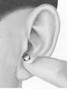 前列腺疾病按摩