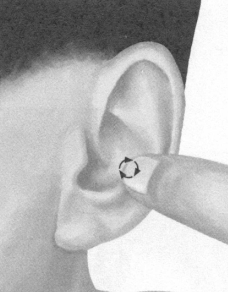 前列腺疾病按摩