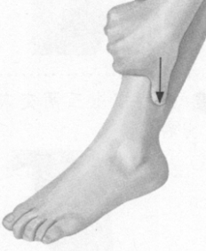 更年期综合征按摩