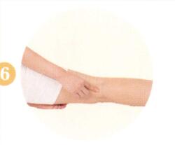 中风后遗症拔罐