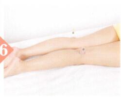 中风后遗症拔罐