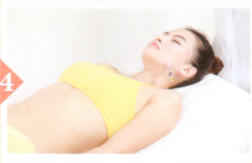 面神经麻痹拔罐