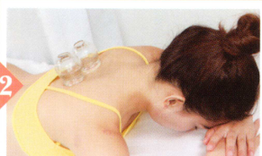 疲劳综合征拔罐