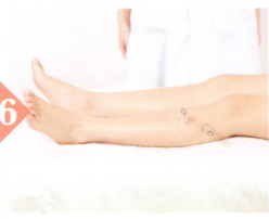 慢性胆囊炎拔罐