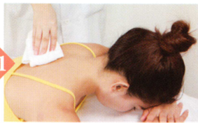 疲劳综合征拔罐